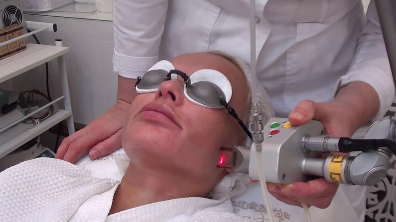 Tratamiento con rayo láser de áreas problemáticas de la piel del rostro. 