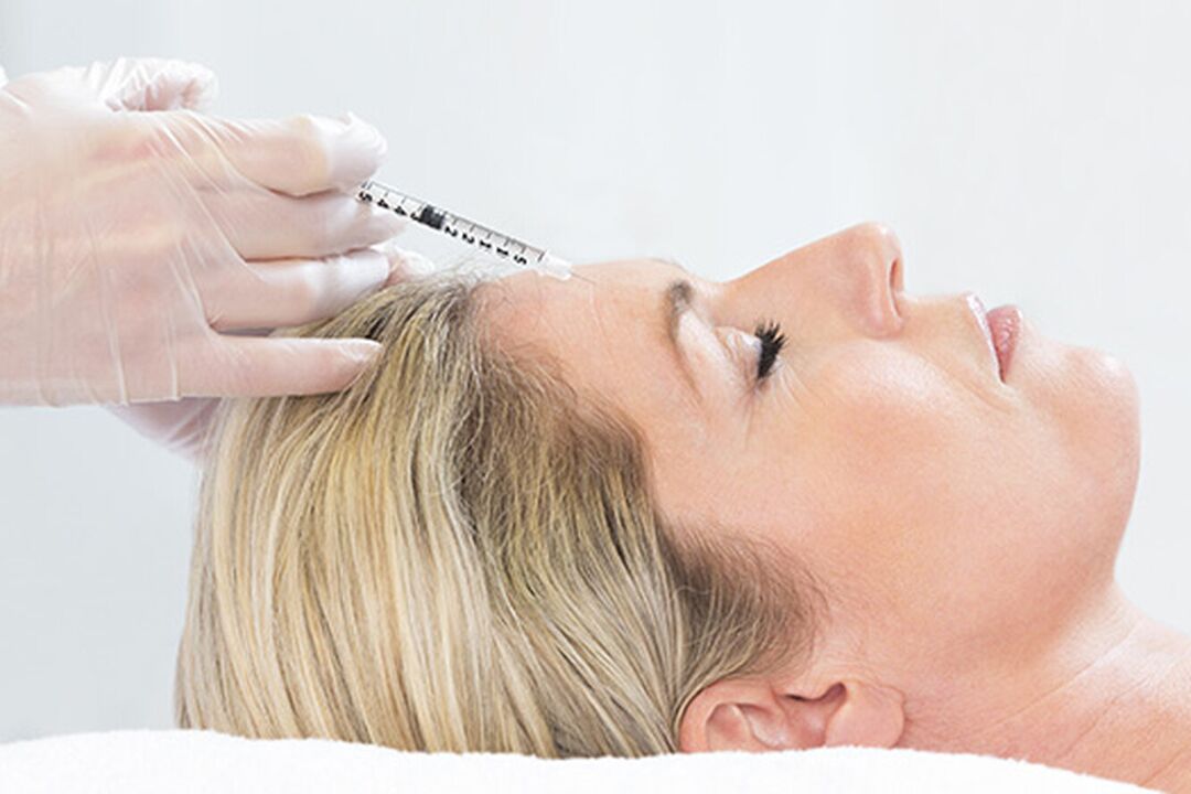 Plasmolifting es un método de inyección para el rejuvenecimiento de la piel del rostro